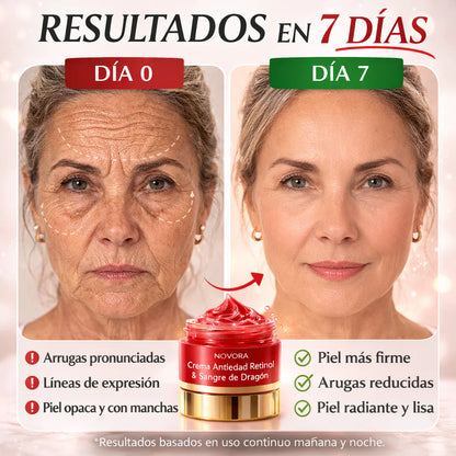 Crema Hidratante Sangre De Dragón - Antienvejecimiento